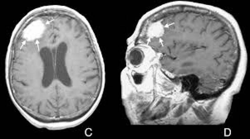 Clínica de Exame de Tomografia Rio Claro - Exame de Ressonância Magnética