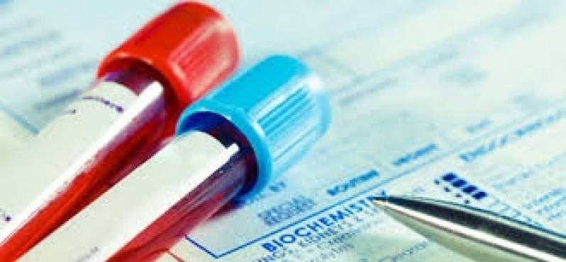 Clínica de Exame para Detecção de HIV em Valinhos - Exames de Sangue