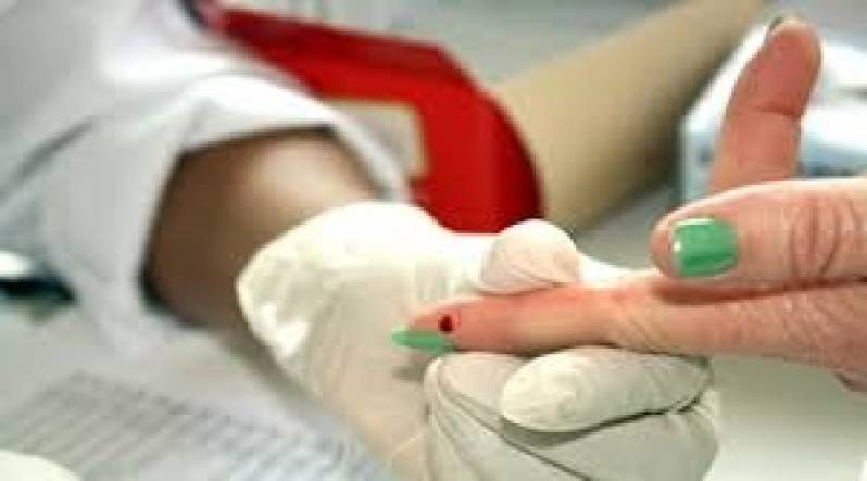 Clínica para Consulta com Infectologista Especialista em Hepatite C na Hortolândia - Consulta com Cardiologista Infantil
