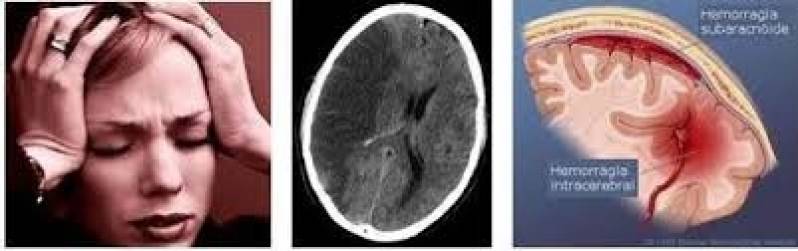 Clínica para Consulta com Neurologista em Americana - Consulta Gastropediatra