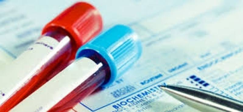 Coleta Domiciliar de Exames Laboratoriais em Campinas - Coleta Domiciliar de Sangue