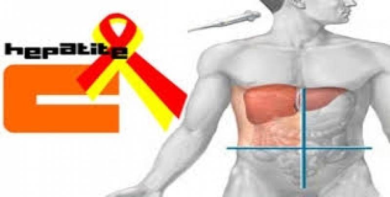 Consulta com Infectologista Especialista em Hepatite C Preço em Limeira - Consulta com Pediatra