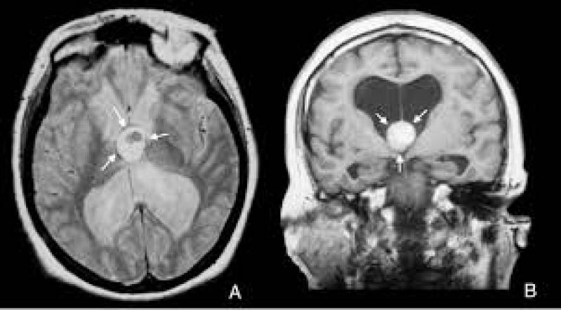 Exame de Ressonância Magnética em Vinhedo - Exame de Tomografia