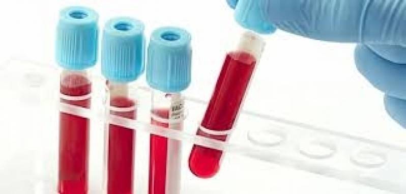 Exame de Sangue na Santa Bárbara D'Oeste - Exames Laboratoriais