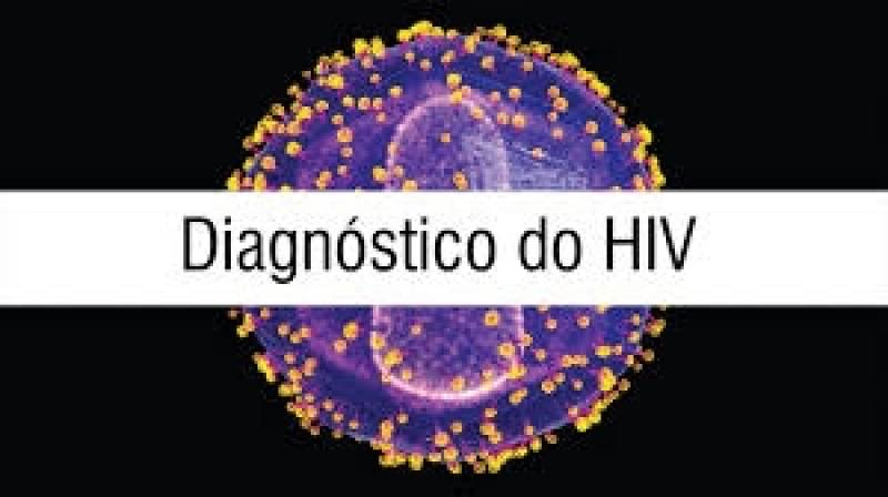 Exame para Detecção de HIV Preço em Americana - Exames Laboratoriais