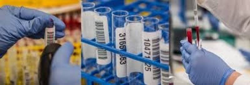 Exame para Detecção de HIV em Itatiba - Exames Laboratoriais