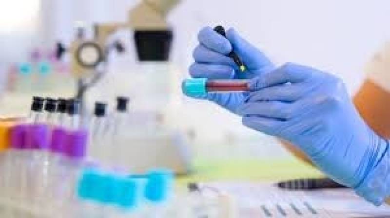 Exames Farmacogenéticos na Indaiatuba - Exame para Detecção de HIV