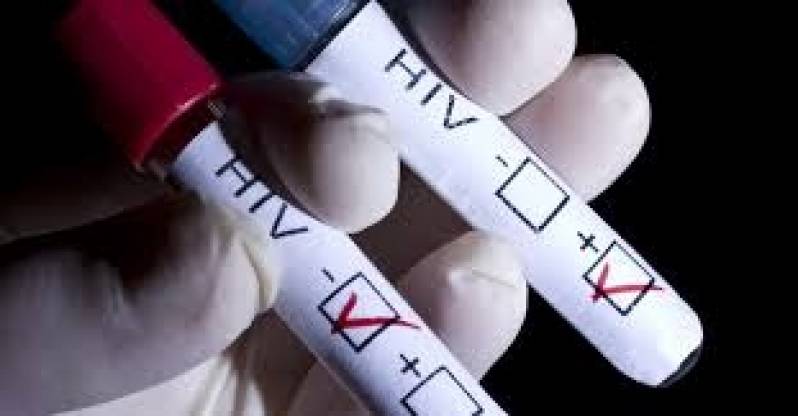 Exames para Detecção de HIV Ribeirão Preto - Elastografia Hepática por Fibroscan