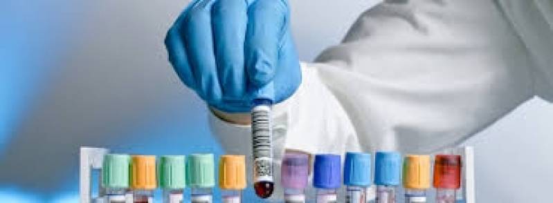 Quanto Custa Exames de Sangue em Artur Nogueira - Exame para Detecção de HIV