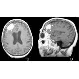 clínica de exame de tomografia em Itatiba