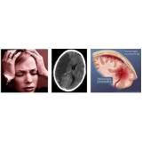 clínica para consulta com neurologista em Itatiba