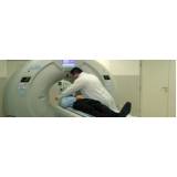 exames de tomografia em Paulínia