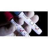 exames para detecção de HIV na Indaiatuba