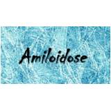 tratamento de amiloidose