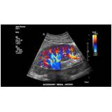 ultrassons de abdome superior e total na Atibaia
