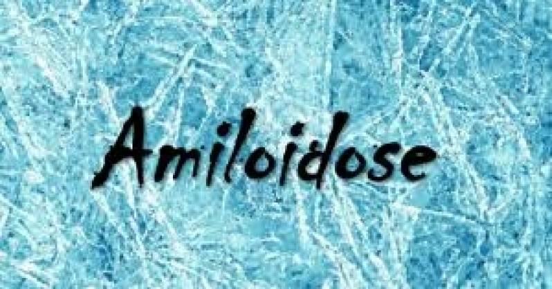 Tratamento de Amiloidose em Sumaré - Tratamento de Amiloidose