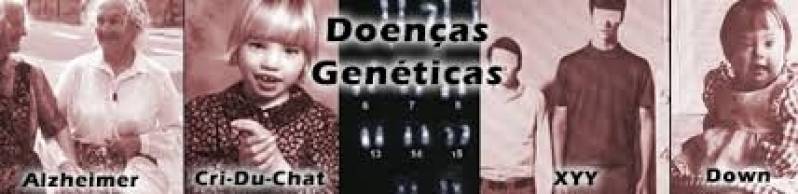 Tratamento para Síndrome Genéticas Preço em Valinhos - Tratamento para Síndrome Genéticas