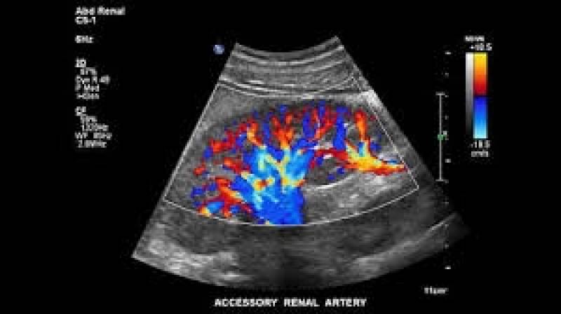 Ultrassons de Abdome Superior e Total na Indaiatuba - Exame de Tomografia